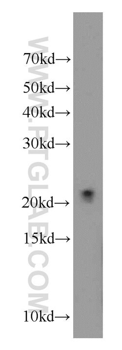COQ7 Rabbit anti-Human, Mouse, Rat, Polyclonal, Proteintech 20 &mu;L; Unconjugated:Antibodies,
