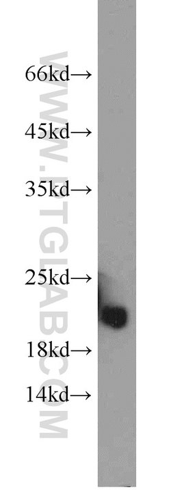 COQ7 Rabbit anti-Human, Mouse, Rat, Polyclonal, Proteintech 20 &mu;L; Unconjugated:Antibodies,