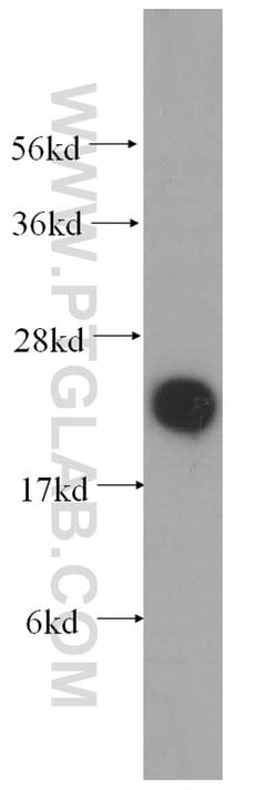 COQ7 Rabbit anti-Human, Mouse, Rat, Polyclonal, Proteintech 20 &mu;L; Unconjugated:Antibodies,