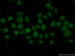 POLR2H Rabbit anti-Human, Mouse, Rat, Polyclonal, Proteintech 150 μL;