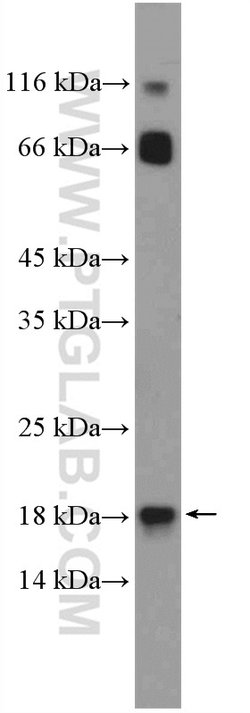 POLR2H Rabbit anti-Human, Mouse, Rat, Polyclonal, Proteintech 150 μL;