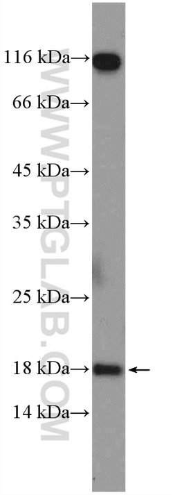 POLR2H Rabbit anti-Human, Mouse, Rat, Polyclonal, Proteintech 150 μL;