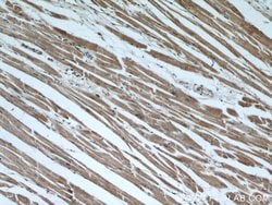 INPP5K Rabbit anti-Human, Mouse, Rat, Polyclonal, Proteintech 150 &mu;L;