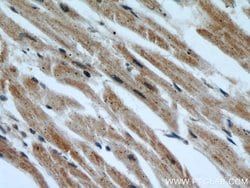 INPP5K Rabbit anti-Human, Mouse, Rat, Polyclonal, Proteintech 150 &mu;L;