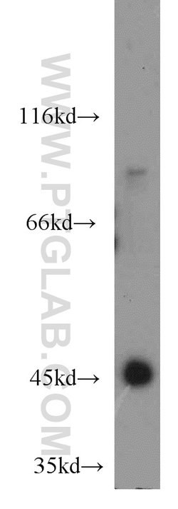 INPP5K Rabbit anti-Human, Mouse, Rat, Polyclonal, Proteintech 150 &mu;L;