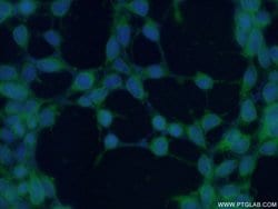 INPP5K Rabbit anti-Human, Mouse, Rat, Polyclonal, Proteintech 150 &mu;L;