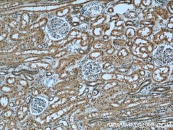 INPP5K Rabbit anti-Human, Mouse, Rat, Polyclonal, Proteintech 150 &mu;L;