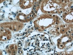 INPP5K Rabbit anti-Human, Mouse, Rat, Polyclonal, Proteintech 150 &mu;L;