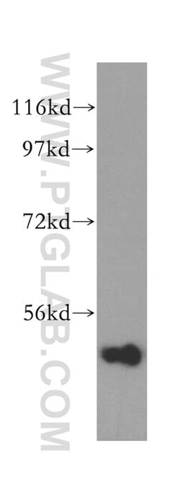 INPP5K Rabbit anti-Human, Mouse, Rat, Polyclonal, Proteintech 150 &mu;L;