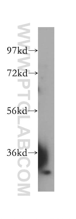 DHDDS Rabbit anti-Human, Mouse, Rat, Polyclonal, Proteintech
