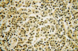 TNIP1 Rabbit anti-Human, Mouse, Polyclonal, Proteintech:Antibodies:Primary