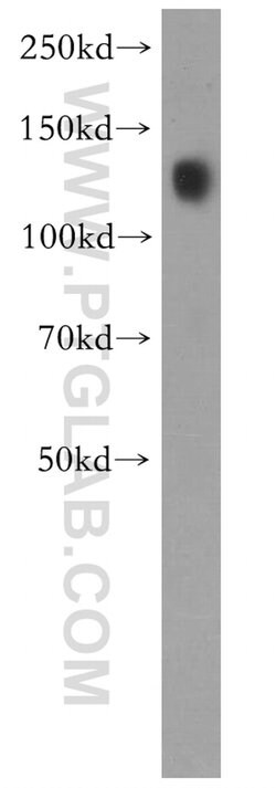 Cadherin-16 Rabbit anti-Human, Mouse, Rat, Polyclonal, Proteintech 150