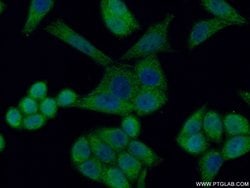 HCCS Rabbit anti-Human, Mouse, Rat, Polyclonal, Proteintech 150 &mu;L;