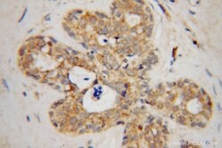 HCCS Rabbit anti-Human, Mouse, Rat, Polyclonal, Proteintech 150 &mu;L;
