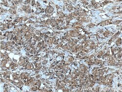 HCCS Rabbit anti-Human, Mouse, Rat, Polyclonal, Proteintech 150 &mu;L;
