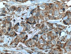 HCCS Rabbit anti-Human, Mouse, Rat, Polyclonal, Proteintech 150 &mu;L;