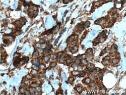 HCCS Rabbit anti-Human, Mouse, Rat, Polyclonal, Proteintech 150 &mu;L;