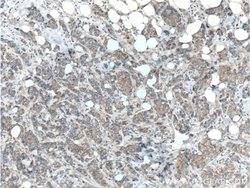 HCCS Rabbit anti-Human, Mouse, Rat, Polyclonal, Proteintech 150 &mu;L;