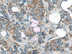HCCS Rabbit anti-Human, Mouse, Rat, Polyclonal, Proteintech 150 &mu;L;