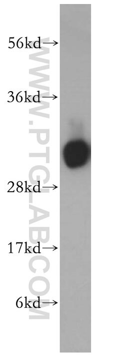 HCCS Rabbit anti-Human, Mouse, Rat, Polyclonal, Proteintech 150 &mu;L;