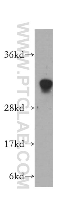 HCCS Rabbit anti-Human, Mouse, Rat, Polyclonal, Proteintech 150 &mu;L;