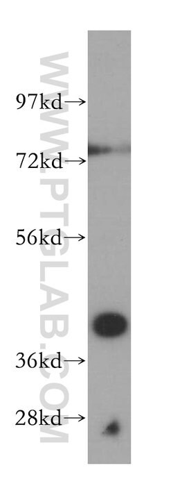Proteintech Group Inc SCAMP2 Rabbit anti-Human, Mouse, Rat, Polyclonal, Proteintech