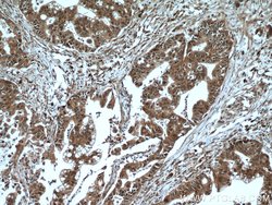 GSTO1 Rabbit anti-Human, Mouse, Rat, Polyclonal, Proteintech 20 &mu;L | Buy Online | Proteintech | Fisher Scientific