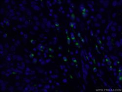 GP73/GOLPH2 Rabbit anti-Human, Polyclonal, Proteintech 150 &mu;L; Unconjugated:Antibodies,