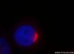 GP73/GOLPH2 Rabbit anti-Human, Polyclonal, Proteintech 150 &mu;L; Unconjugated:Antibodies,