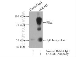 GP73/GOLPH2 Rabbit anti-Human, Polyclonal, Proteintech 150 &mu;L; Unconjugated:Antibodies,