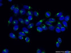 GP73/GOLPH2 Rabbit anti-Human, Polyclonal, Proteintech 150 &mu;L; Unconjugated:Antibodies,