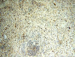 GP73/GOLPH2 Rabbit anti-Human, Polyclonal, Proteintech 150 &mu;L; Unconjugated:Antibodies,