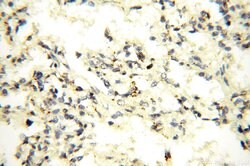 GP73/GOLPH2 Rabbit anti-Human, Polyclonal, Proteintech 150 &mu;L; Unconjugated:Antibodies,