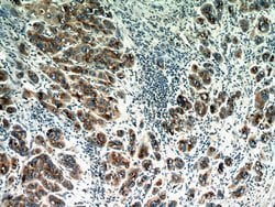 GP73/GOLPH2 Rabbit anti-Human, Polyclonal, Proteintech 150 &mu;L; Unconjugated:Antibodies,