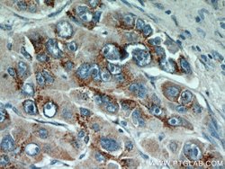 GP73/GOLPH2 Rabbit anti-Human, Polyclonal, Proteintech 150 &mu;L; Unconjugated:Antibodies,