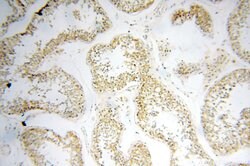 GP73/GOLPH2 Rabbit anti-Human, Polyclonal, Proteintech 150 &mu;L; Unconjugated:Antibodies,