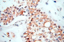 GP73/GOLPH2 Rabbit anti-Human, Polyclonal, Proteintech 150 &mu;L; Unconjugated:Antibodies,