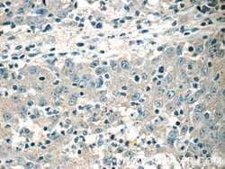 HSCB Rabbit anti-Human, Polyclonal, Proteintech:Antibodies:Primary Antibodies