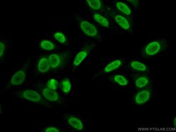 HRP 2 Rabbit anti-Human, Mouse, Rat, Polyclonal, Proteintech:Antibodies:Primary