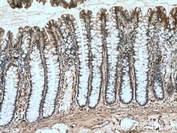 HRP 2 Rabbit anti-Human, Mouse, Rat, Polyclonal, Proteintech:Antibodies:Primary