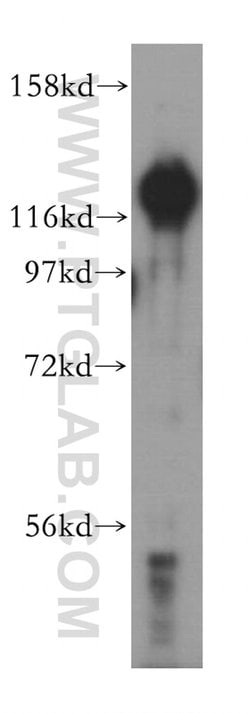 HRP 2 Rabbit anti-Human, Mouse, Rat, Polyclonal, Proteintech:Antibodies:Primary