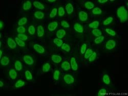 HRP 2 Rabbit anti-Human, Mouse, Rat, Polyclonal, Proteintech:Antibodies:Primary