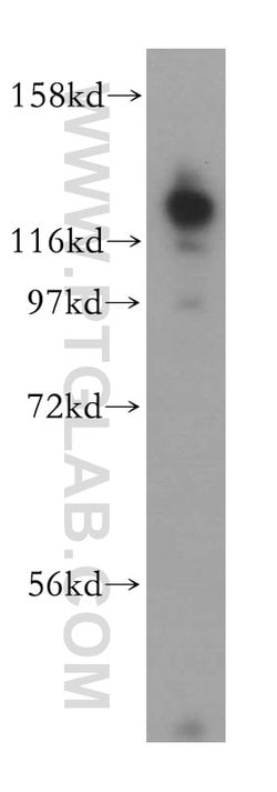 HRP 2 Rabbit anti-Human, Mouse, Rat, Polyclonal, Proteintech:Antibodies:Primary