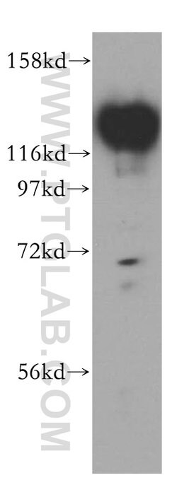 HRP 2 Rabbit anti-Human, Mouse, Rat, Polyclonal, Proteintech:Antibodies:Primary