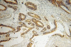 Creatine kinase B type Rabbit anti-Human, Mouse, Rat, Polyclonal, Proteintech 150 &mu;L | Buy Online | Proteintech Group Inc | Fisher Scientific