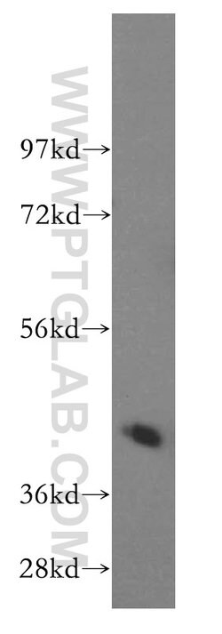 Creatine kinase B type Rabbit anti-Human, Mouse, Rat, Polyclonal, Proteintech 150 &mu;L | Buy Online | Proteintech Group Inc | Fisher Scientific