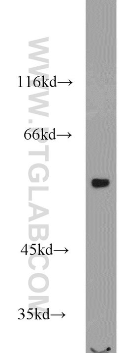 VPS72 Rabbit anti-Human, Mouse, Rat, Polyclonal, Proteintech:Antibodies:Primary