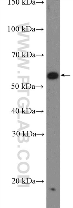 VPS72 Rabbit anti-Human, Mouse, Rat, Polyclonal, Proteintech:Antibodies:Primary