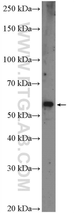 VPS72 Rabbit anti-Human, Mouse, Rat, Polyclonal, Proteintech:Antibodies:Primary