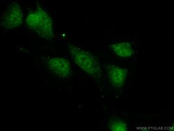 PPIL1 Rabbit anti-Human, Mouse, Rat, Polyclonal, Proteintech 150 &mu;L;